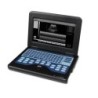 Digital Laptop Machine Ultrasound Scanner Convex 3.5Mhz Probe Abdominal