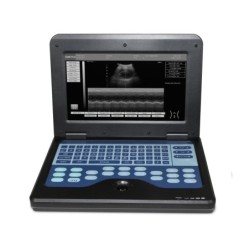Digital Laptop Machine Ultrasound Scanner Convex 3.5Mhz Probe Abdominal